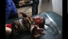 Un niño herido llora mientras recibe tratamiento en un hospital improvisado en Hamouria, Siria.