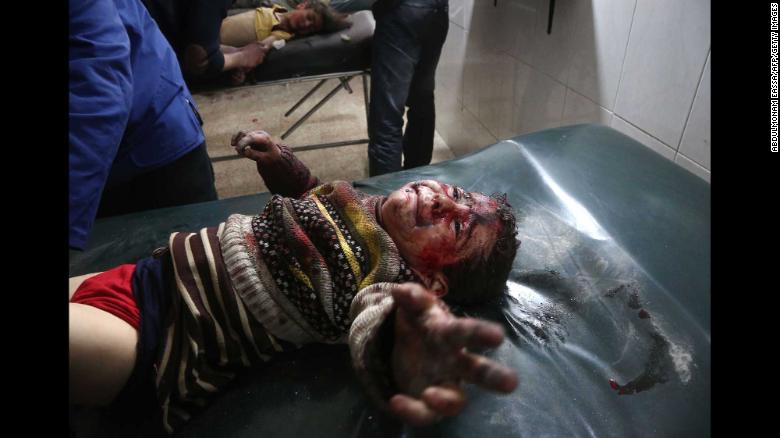 Un niño herido llora mientras recibe tratamiento en un hospital improvisado en Hamouria, Siria.