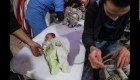 Niños heridos son tratados en un hospital en la ciudad rebelde de Douma.