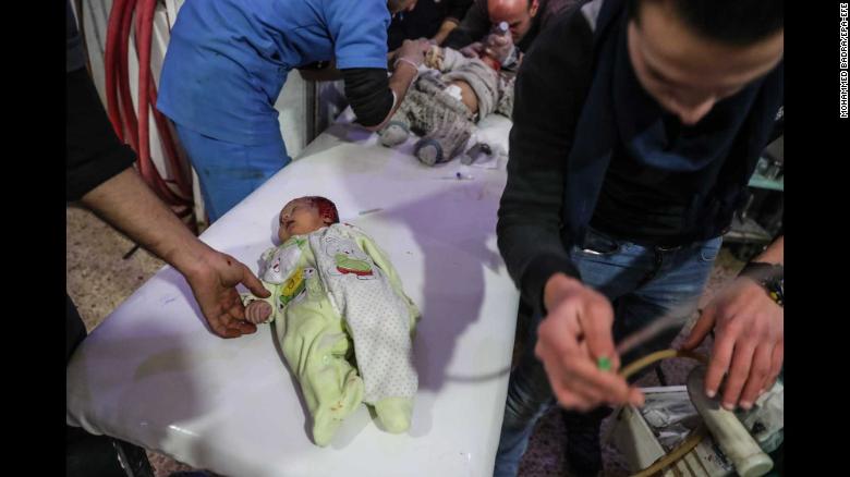 Niños heridos son tratados en un hospital en la ciudad rebelde de Douma.