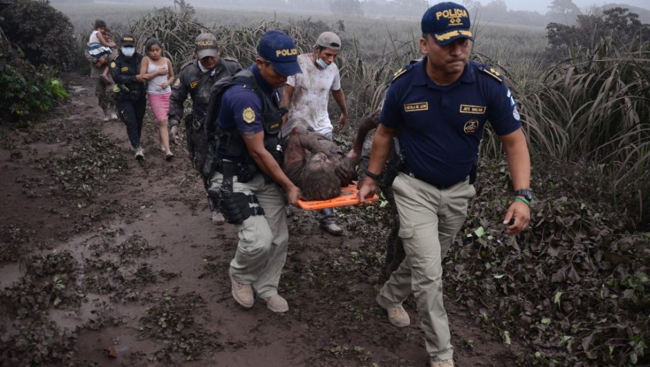 TOPSHOT - Police officers carry a wounded man after the eruption of the Fuego Volcano, in El Rodeo village, Escuintla department, 35 km south of Guatemala City on June 3, 2018. (Photo by NOE PEREZ / AFP) (Photo credit should read NOE PEREZ/AFP/Getty Images)