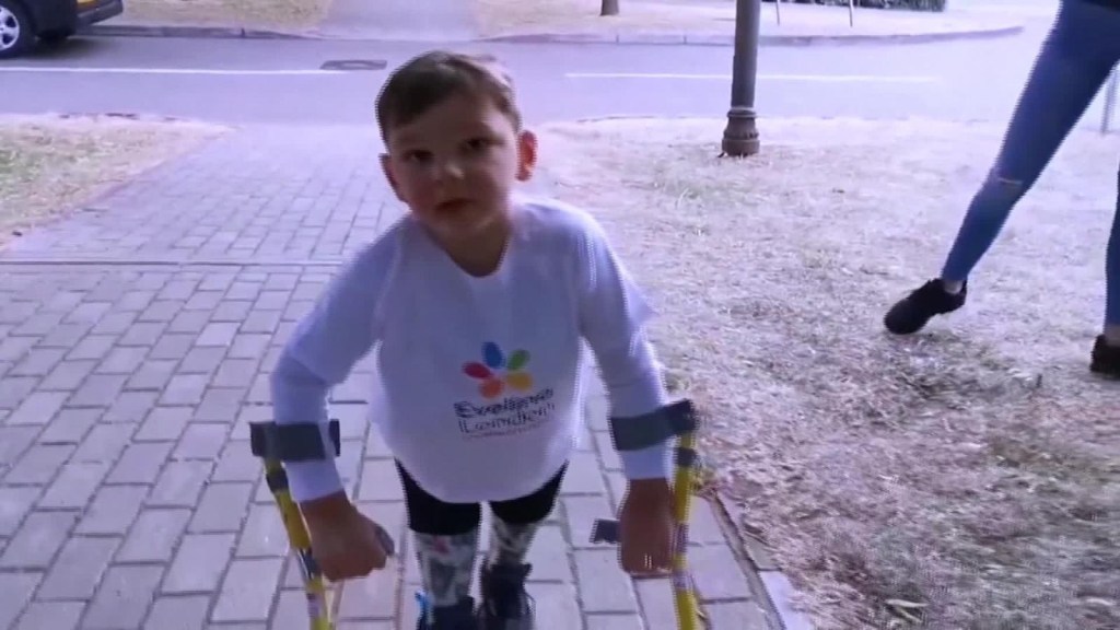 Niño con prótesis de piernas recauda más de US$1 millón para hospital al caminar más de 9 kilómetros