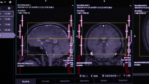 ¿Cómo puede la IA 'traducir' imágenes de tu cerebro a palabras?