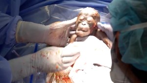 Bebé orangután en peligro de extinción nace por cesárea